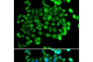 Immunofluorescence analysis of U2OS cells using APOBEC3C Polyclonal Antibody (APOBEC3C Antikörper)
