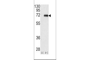 Western blot analysis of PRKCI (arrow) using rabbit polyclonal PKC iota Antibody (N-term) (ABIN391010 and ABIN2841183). (PKC iota Antikörper  (N-Term))