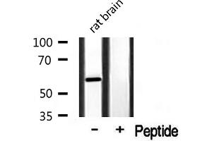 Western blot analysis of extracts from rat Brian, using Cytochrome P450 3A4/5 antibody. (Cytochrome P450 3A4, 3A5 Antikörper)