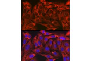 Immunofluorescence analysis of U2OS cells using TXLNA Rabbit pAb (ABIN7270744) at dilution of 1:150 (40x lens). (alpha Taxilin Antikörper)