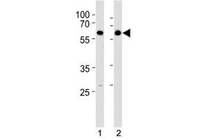 Western Blotting (WB) image for anti-Histone Deacetylase 2 (HDAC2) (AA 410-439) antibody (ABIN3031225)