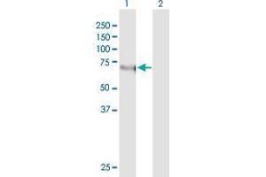 Western Blot analysis of KLF11 expression in transfected 293T cell line by KLF11 monoclonal antibody (M03), clone 10D8. (KLF11 Antikörper  (AA 404-512))