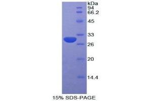 SDS-PAGE (SDS) image for Alanine Aminotransferase (ALT) (AA 203-443) protein (His tag) (ABIN1879324)