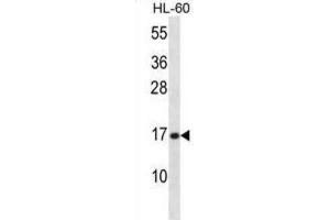 Western Blotting (WB) image for anti-phospholipase A2, Group V (PLA2G5) antibody (ABIN2998220) (PLA2G5 Antikörper)