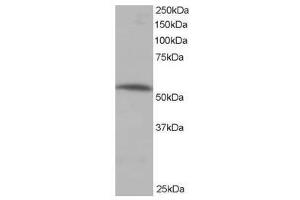 Image no. 1 for anti-Protein Phosphatase 2, Regulatory Subunit B', alpha (PPP2R5A) (C-Term) antibody (ABIN374133) (PPP2R5A Antikörper  (C-Term))