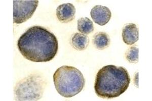 Immunohistochemistry (IHC) image for anti-Chemokine (C-X-C Motif) Receptor 4 (CXCR4) (N-Term) antibody (ABIN1031336) (CXCR4 Antikörper  (N-Term))