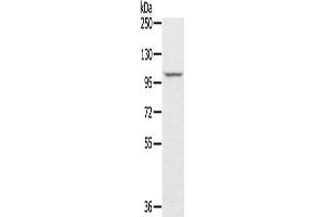 Gel: 6 % SDS-PAGE, Lysate: 40 μg, Lane: A549 cells, Primary antibody: ABIN7131212(STARD8 Antibody) at dilution 1/250, Secondary antibody: Goat anti rabbit IgG at 1/8000 dilution, Exposure time: 10 seconds (STARD8 Antikörper)