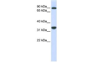 Western Blotting (WB) image for anti-Ribosomal RNA Processing 1 Homolog B (RRP1B) antibody (ABIN2458964) (RRP1B Antikörper)