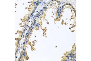 Immunohistochemistry of paraffin-embedded human prostate using NLGN4Y antibody (ABIN6133011, ABIN6144652, ABIN6144653 and ABIN6220667) at dilution of 1:100 (40x lens).