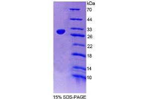 SDS-PAGE analysis of Human SGCd Protein. (SGCD Protein)