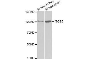 Western blot analysis of extracts of various cell lines, using ITGB5 antibody. (Integrin beta 5 Antikörper  (AA 490-720))
