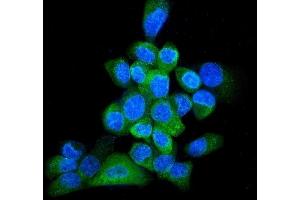 IF analysis of GRP94 using anti-GRP94 antibody (ABIN3042463).