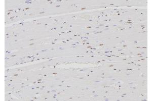 ABIN6276467 at 1/100 staining Rat heart tissue by IHC-P.