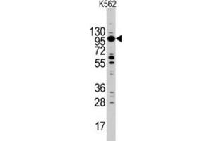 Western Blotting (WB) image for anti-Myosin ID (MYO1D) antibody (ABIN3002631)