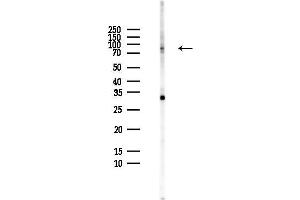 anti-G Protein-Coupled Receptor Kinase Interactor 2 (GIT2) (Internal Region) antibody