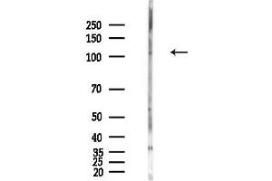 Western blot analysis of lysates from PC12 cells(LPS,4h treatment), using TRPC4 Antibody at 1/1000 dilution.