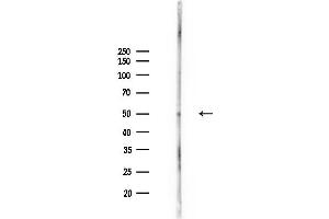 anti-Tyrosinase-Related Protein 1 (TYRP1) (Internal Region) antibody