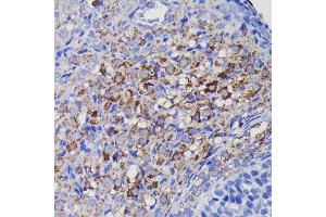 Immunohistochemistry of paraffin-embedded rat ovary using SOD2 antibody (ABIN7270638) at dilution of 1:100 (40x lens). (SOD2 Antikörper)
