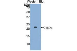 Western Blotting (WB) image for anti-Glucosidase, Alpha, Acid (GAA) (AA 595-770) antibody (ABIN1858936) (GAA Antikörper  (AA 595-770))