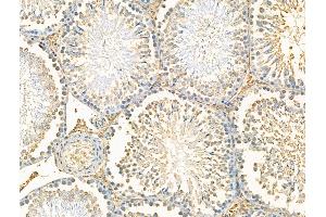 ABIN7094574 and ABIN7098623 at 1/100 staining Rat testis tissue by IHC-P. (RPS29 Antikörper  (N-Term))