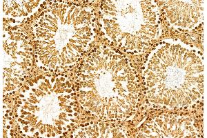 ABIN6263746 and ABIN6272947 at 1/100 staining Rat testis tissue by IHC-P. (NSUN2 Antikörper  (Internal Region))