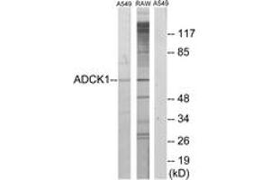 Western blot analysis of extracts from A549/RAW264. (ADCK1 Antikörper  (AA 251-300))