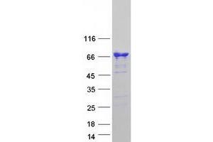 Validation with Western Blot