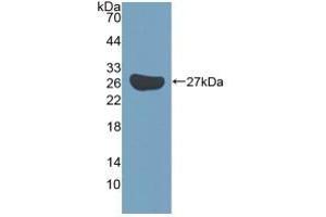 KATNA1 Antikörper  (AA 260-491)