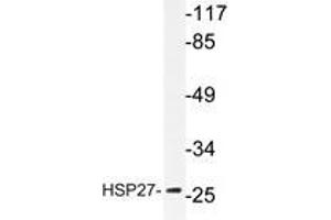 Western blot analyzes of HSP27 antibody in extracts from Jurkat cells. (HSP27 Antikörper)