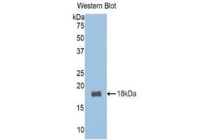 Western blot analysis of the recombinant protein. (TCF20 Antikörper  (AA 392-524))