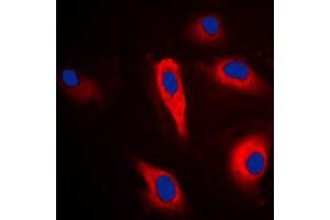 Immunofluorescent analysis of PLA2G4A staining in HeLa cells. (PLA2G4A Antikörper  (Center))