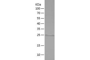 Western Blotting (WB) image for Involucrin (IVL) (AA 408-543) protein (His tag) (ABIN7282527) (Involucrin Protein (IVL) (AA 408-543) (His tag))