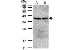 Image no. 1 for anti-Protein Phosphatase 2, Catalytic Subunit, beta Isozyme (PPP2CB) (AA 134-291) antibody (ABIN467440) (PPP2CB Antikörper  (AA 134-291))