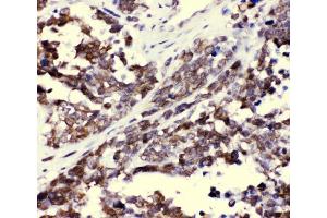 IHC analysis of CCT3 using anti-CCT3 antibody (ABIN4886513).