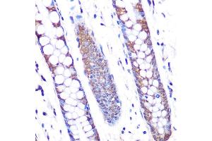 Immunohistochemistry of paraffin-embedded human colon using SKP2 Rabbit mAb (ABIN1680764, ABIN3018459, ABIN3018460 and ABIN7101615) at dilution of 1:100 (40x lens).