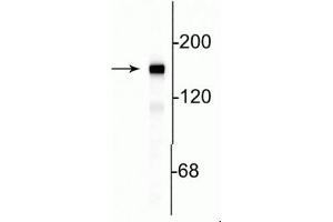 Western blot of rat cortical lysate showing specific immunolabeling of the ~145 kDa NF-M protein. (NEFM Antikörper  (C-Term))