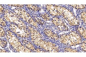 Immunohistochemistry (IHC) image for anti-Inducible T-Cell Co-Stimulator Ligand (ICOSLG) (AA 23-249) antibody (ABIN7439975)