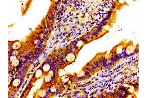 Immunohistochemistry of paraffin-embedded human small intestine tissue using ABIN7159843 at dilution of 1:100 (MTCH2 Antikörper  (AA 31-131))