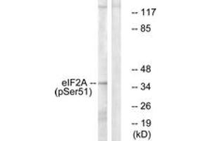 Western blot analysis of extracts from K562 cells treated with IFN-alpha 1000U/ml 18h, using eIF2 alpha (Phospho-Ser51) Antibody. (EIF2A Antikörper  (pSer52))