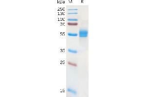 Human A Protein, hFc Tag on SDS-PAGE under reducing condition.