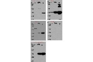 Immunoprecipitating Flag Tag in 293F transfected whole cell lysate Lane 1: Mouse control IgG instead of  in Flag Tag in 293F transfected whole cell lysate. (DYKDDDDK Tag Antikörper)