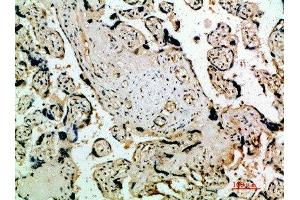 Immunohistochemical analysis of paraffin-embedded human-placenta, antibody was diluted at 1:200 (FLT4 Antikörper  (AA 640-700))