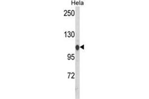 Western blot analysis of HSPA4L Antibody (C-term) in Hela cell line lysates (35ug/lane). (HSPA4L Antikörper  (C-Term))
