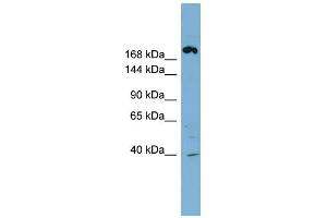 WB Suggested Anti-ABCC11 Antibody Titration:  0. (ABCC11 Antikörper  (Middle Region))