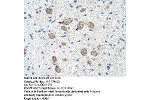 Human Brain (KLHL25 Antikörper  (N-Term))