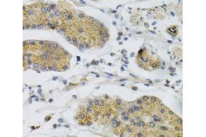 Immunohistochemistry of paraffin-embedded Human stomach using PTPRA Polyclonal Antibody at dilution of 1:100 (40x lens). (PTPRA Antikörper)