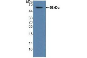 Detection of Recombinant ALDH1A1, Human using Polyclonal Antibody to Aldehyde Dehydrogenase 1 Family, Member A1 (ALDH1A1) (ALDH1A1 Antikörper  (AA 2-501))