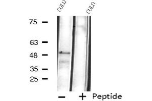 Western blot analysis of extracts from COLO cells, using Cytochrome P450 4B1 antibody. (CYP4B1 Antikörper  (Internal Region))