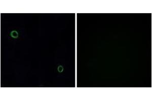 Immunofluorescence analysis of A549 cells, using CXCR4 Antibody. (CXCR4 Antikörper  (AA 300-349))
