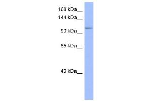WB Suggested Anti-MSH4 Antibody Titration:  0. (MSH4 Antikörper  (Middle Region))